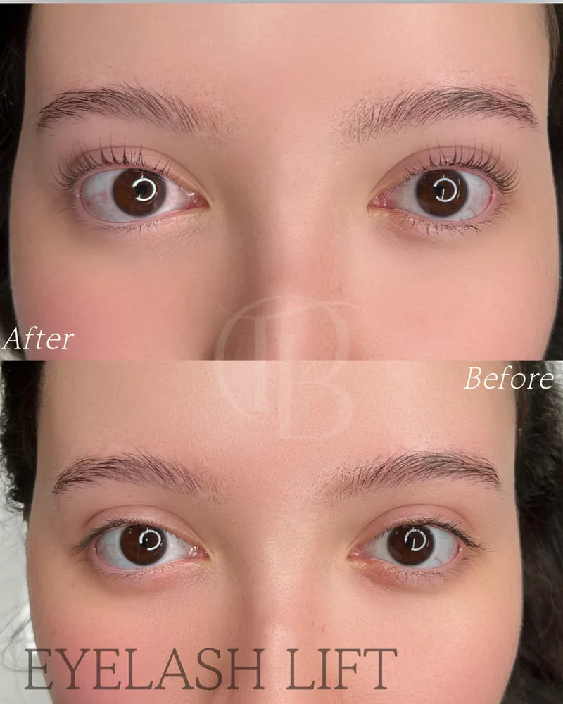Lash Lift